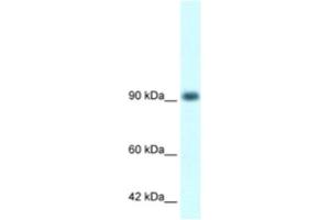 Western Blotting (WB) image for anti-RNA Binding Motif Protein 10 (RBM10) antibody (ABIN2460170)