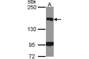 WB Image Sample (30 ug of whole cell lysate) A: Hela 5% SDS PAGE FANCJ antibody antibody diluted at 1:1000