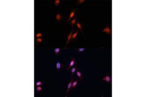 Immunofluorescence analysis of HeLa cells using Smad5 Polyclonal Antibody (ABIN6128714, ABIN6148090, ABIN6148091 and ABIN6218232) at dilution of 1:100 (40x lens). (SMAD5 antibody  (AA 186-465))