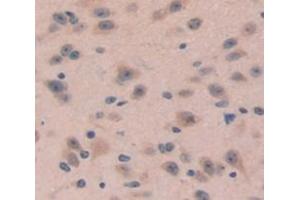 Figure. (DKK4 antibody  (AA 37-141))