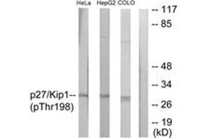 Western blot analysis of extracts from HeLa cells, HepG2 cells and COLO cells, using p27 Kip1 (Phospho-Thr198) Antibody. (CDKN1B antibody  (pThr198))
