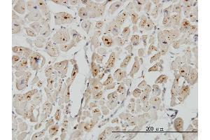 Immunoperoxidase of monoclonal antibody to ASAH1 on formalin-fixed paraffin-embedded human heart. (ASAH1 antibody  (AA 25-124))