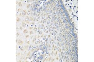 Immunohistochemistry of paraffin-embedded human esophagus using OXCT1 antibody (ABIN5974499) at dilution of 1/100 (40x lens). (OXCT1 antibody)