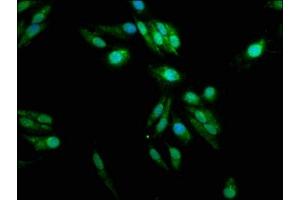 Immunofluorescence staining of Hela cells with ABIN7166389 at 1:100, counter-stained with DAPI. (PADI2 antibody  (AA 1-665))