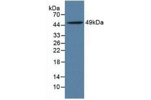 Detection of LILRB4 in Rat Adrenal Gland Tissue using Polyclonal Antibody to Leukocyte Immunoglobulin Like Receptor Subfamily B, Member 4 (LILRB4) (LILRB4 antibody  (AA 24-206))