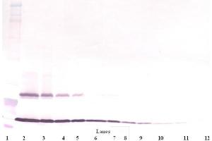 Western Blot (Unreduced) using TSLP antibody (Thymic Stromal Lymphopoietin antibody)
