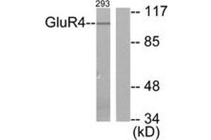 Western blot analysis of extracts from 293 cells, treated with Forskolin 40nM 30', using mGluR4 Antibody. (Metabotropic Glutamate Receptor 4 antibody  (AA 851-900))