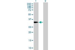 Western Blot analysis of PRKRA expression in transfected 293T cell line by PRKRA MaxPab polyclonal antibody. (PRKRA antibody  (AA 1-313))