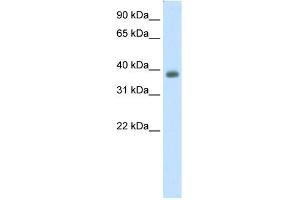 WB Suggested Anti-NEUROD2 Antibody Titration:  0. (NEUROD2 antibody  (C-Term))