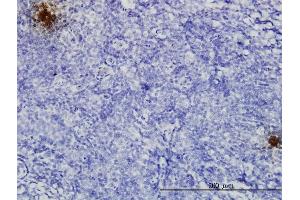 Immunoperoxidase of monoclonal antibody to TFPI2 on formalin-fixed paraffin-embedded human tonsil. (TFPI2 antibody  (AA 1-235))