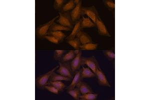 Immunofluorescence analysis of U-2 OS cells using 43711 antibody (ABIN7270204) at dilution of 1:100. (Septin 3 antibody  (AA 179-358))