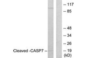 Western blot analysis of extracts from Jurkat cells, treated with Etoposide 25uM 24h, using Caspase 7 (Cleaved-Asp198) Antibody.