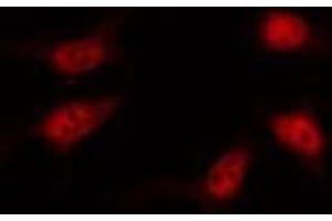 ABIN6267371 staining HT29 by IF/ICC. (Vitamin D Receptor antibody  (pSer208))