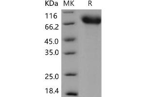TRKA Protein (His tag)