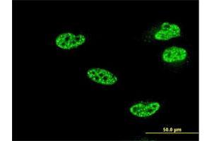Immunofluorescence of monoclonal antibody to NFKB1 on HeLa cell. (NFKB1 antibody  (AA 860-969))