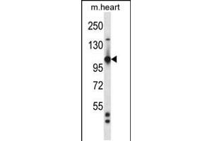 Western blot analysis in mouse heart tissue lysates (35ug/lane). (TIE1 antibody  (AA 361-389))