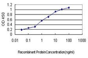 Detection limit for recombinant GST tagged GUCY2D is approximately 0. (GUCY2D antibody  (AA 521-630))
