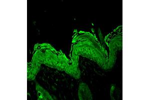 Hsp90, Mouse backskin (HSP90 antibody)