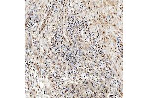IHC analysis of SNRNP27 using anti-SNRNP27 antibody (ABIN7599614). (SNRNP27 antibody  (AA 100-155))