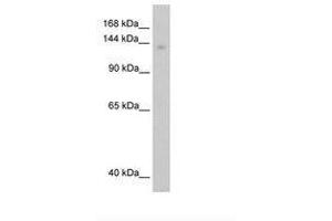 Image no. 2 for anti-Moloney Leukemia Virus 10 (MOV10) (C-Term) antibody (ABIN204954) (MOV10 antibody  (C-Term))