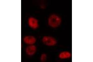 ABIN6274347 staining HepG2 cells by IF/ICC. (DYRK1A antibody  (N-Term))