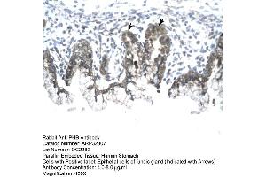 Human Stomach (Prohibitin antibody  (C-Term))