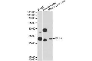 Western blot analysis of extracts of various cell lines, using VAPA Antibody. (VAPA antibody)