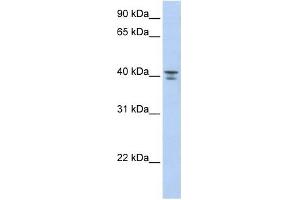 GNA12 antibody used at 1 ug/ml to detect target protein. (GNA12 antibody)