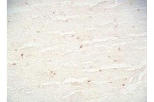 Mouse brain tissue was stained by Rabbit Anti-CB2 Receptor (323-360) Serum (CNR2 antibody  (AA 323-360))
