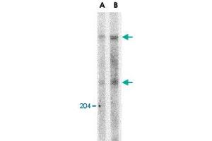 Western blot analysis of ATM in Daudi whole cell lysate with ATM polyclonal antibody  at (A) 1 and (B) 2 ug/mL . (ATM antibody  (C-Term))