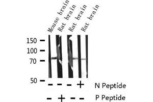 Western blot analysis of Phospho-Synapsin (Ser9) expression in various lysates (SYN1 antibody  (pSer9))