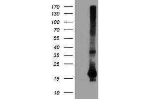 HEK293T cells were transfected with the pCMV6-ENTRY control (Left lane) or pCMV6-ENTRY SAT2 (Right lane) cDNA for 48 hrs and lysed. (SAT2 antibody)