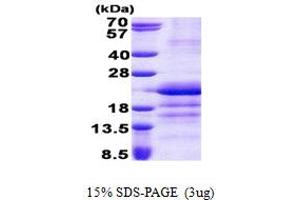 Glutamyl-tRNA Amidotransferase, Subunit C (GATC) (AA 1-136) protein (His tag)