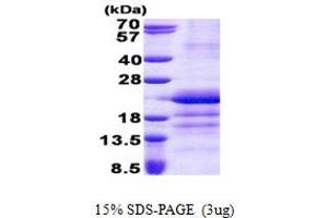 SDS-PAGE (SDS) image for Glutamyl-tRNA Amidotransferase, Subunit C (GATC) (AA 1-136) protein (His tag) (ABIN6387232)