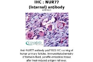 Image no. 1 for anti-Nuclear Receptor Subfamily 4, Group A, Member 1 (NR4A1) (Internal Region) antibody (ABIN1737603) (NR4A1 antibody  (Internal Region))