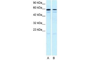 WB Suggested Anti-HTR2C  Antibody Titration: 5. (HTR2C antibody  (N-Term))