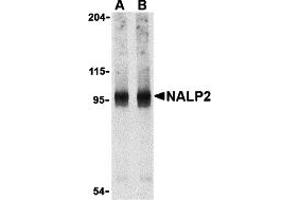 Western Blotting (WB) image for anti-NLR Family, Pyrin Domain Containing 2 (NLRP2) (C-Term) antibody (ABIN1030532) (NLRP2 antibody  (C-Term))
