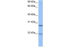 ECT2 antibody used at 1 ug/ml to detect target protein. (ECT2 antibody  (Middle Region))