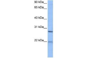ECT2 antibody used at 1 ug/ml to detect target protein.
