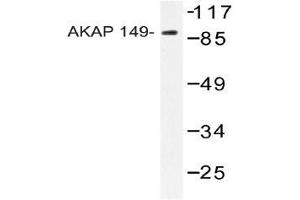 Western blot analysis of AKAP149 Antibody in extracts from HUVEC cells. (AKAP1 antibody)