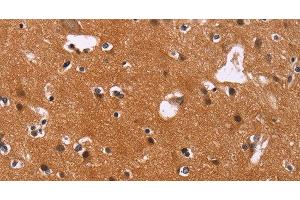 Immunohistochemistry of paraffin-embedded Human brain using CBX3 Polyclonal Antibody at dilution of 1:40 (CBX3 antibody)