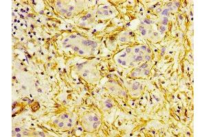 Immunohistochemistry (IHC) image for anti-Actin, alpha 2, Smooth Muscle, Aorta (ACTA2) (AA 3-265) antibody (ABIN7143132)