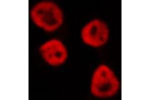 ABIN6268848 staining HeLa cells by IF/ICC. (PPARA antibody  (N-Term))
