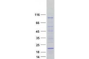 Validation with Western Blot (SYS1 Protein (Transcript Variant 1) (Myc-DYKDDDDK Tag))