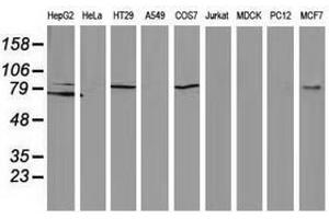 Image no. 2 for anti-Catenin (Cadherin-Associated Protein), beta 1, 88kDa (CTNNB1) antibody (ABIN1496897) (CTNNB1 antibody)