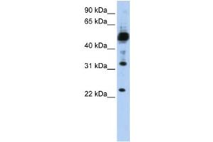 Western Blotting (WB) image for anti-Transmembrane Protein 38B (TMEM38B) antibody (ABIN2459106) (TMEM38B antibody)