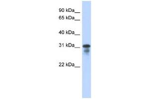 WB Suggested Anti-MED6 Antibody Titration:  0. (MED6 antibody  (Middle Region))