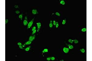 Immunofluorescent analysis of Hela cells using ABIN7150209 at dilution of 1:100 and Alexa Fluor 488-congugated AffiniPure Goat Anti-Rabbit IgG(H+L) (MSH6 antibody  (AA 1-400))