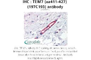 Image no. 1 for anti-Plexin Domain Containing 1 (PLXDC1) (AA 411-427) antibody (ABIN5693726) (PLXDC1 antibody  (AA 411-427))