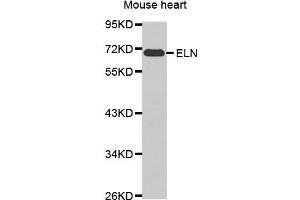 Western blot analysis of extracts of various cell lines, using ELN antibody. (Elastin antibody  (AA 27-200))